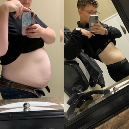 Before and After 14