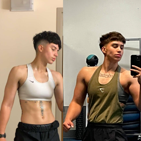 Before and After 18