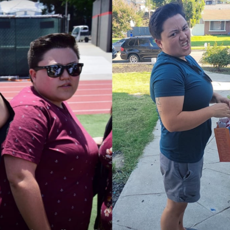 Before and After 22