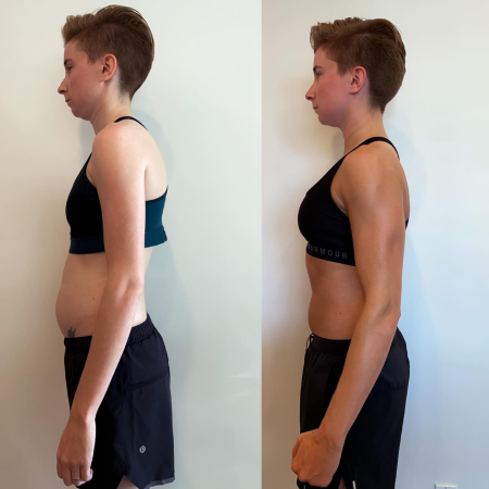 Before and After 26